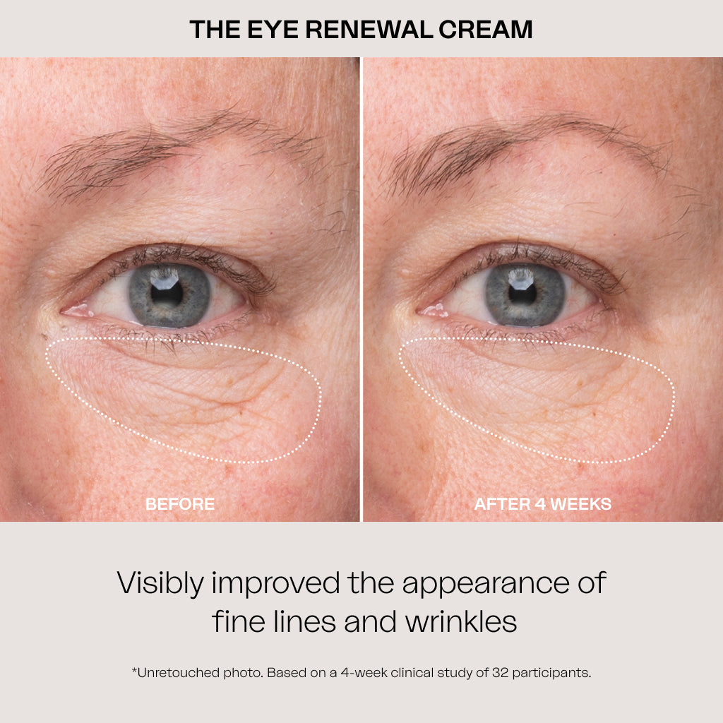 The Signature Treatment: Fine Lines & Wrinkles