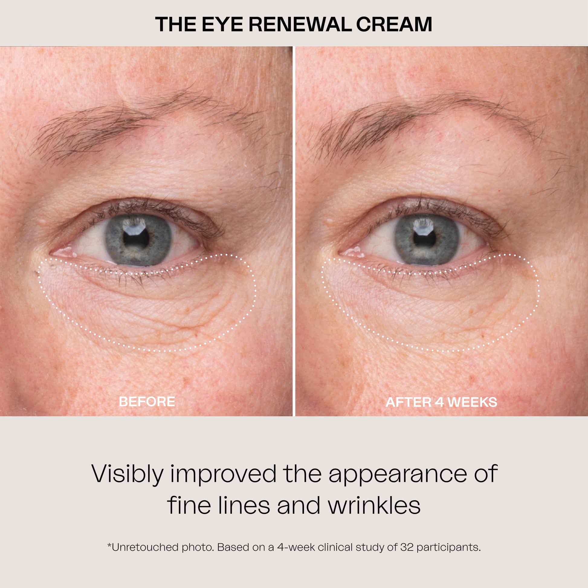 Eighth Day Skin The Eye Renewal Cream. Visibly improved the appearance of fine lines and wrinkles. Based on a 4-week clinical study of 32 participants.