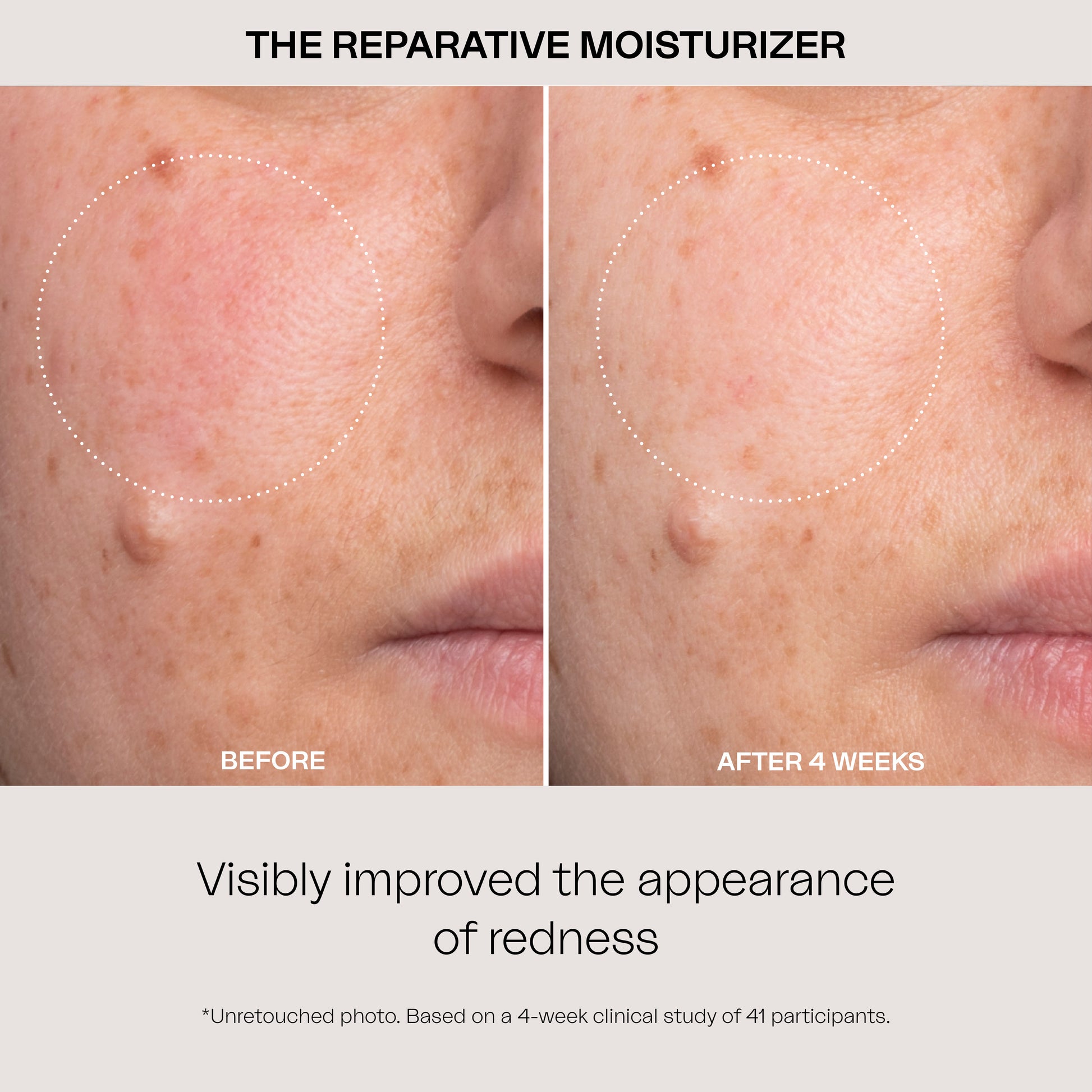 The Reparative Moisturizer visibly improved the appearance of redness. Based on a 4-week clinical study of 41 participants.