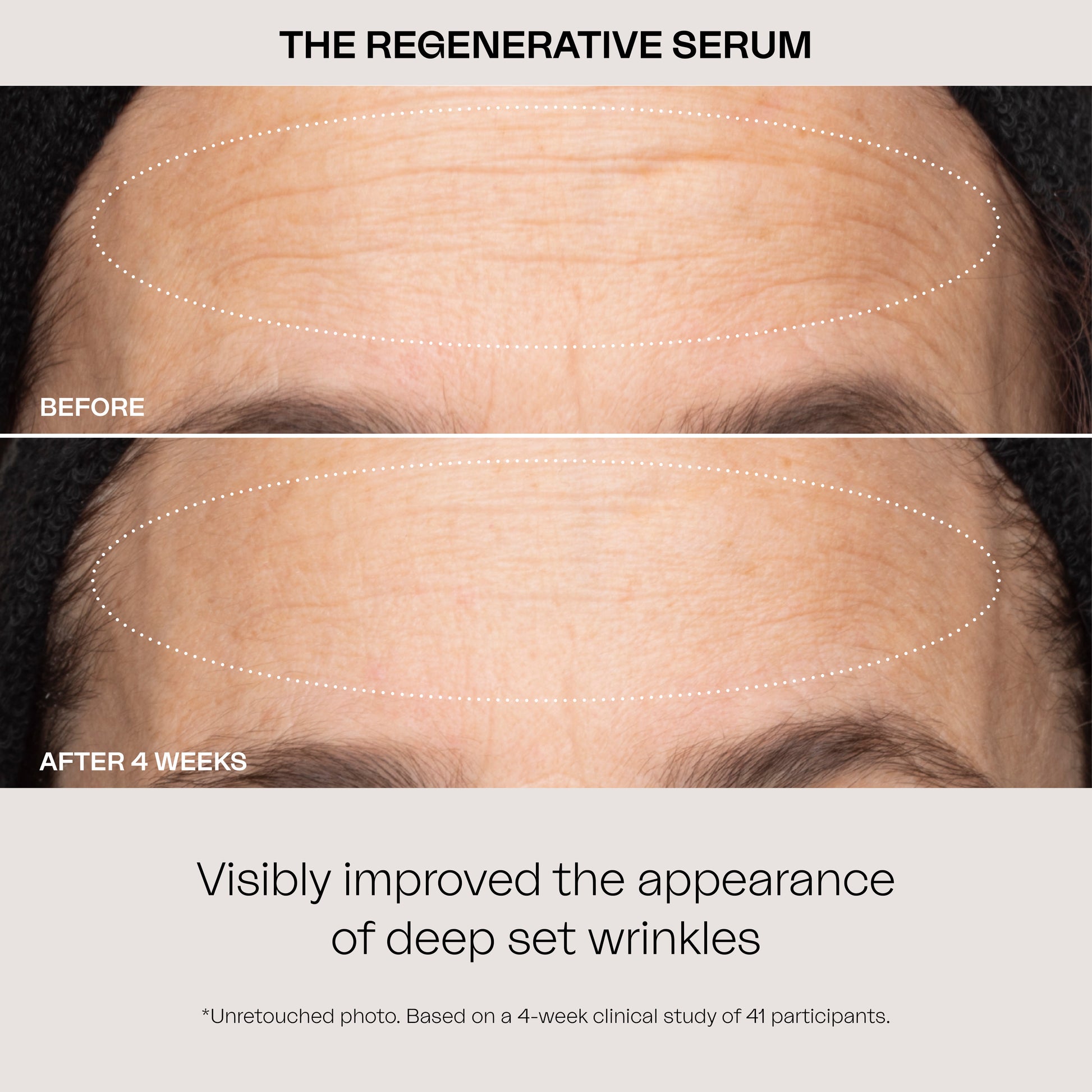 Eighth Day Skin's Regenerative Serum visibly improved the appearance of deep set wrinkles. Unretouched photo. Based on a clinical study of 41 participants.