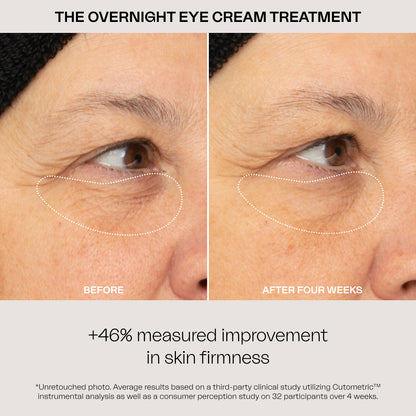The Overnight Eye Cream Treatment