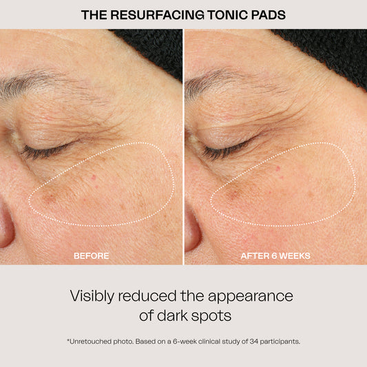The Resurfacing Tonic Pads