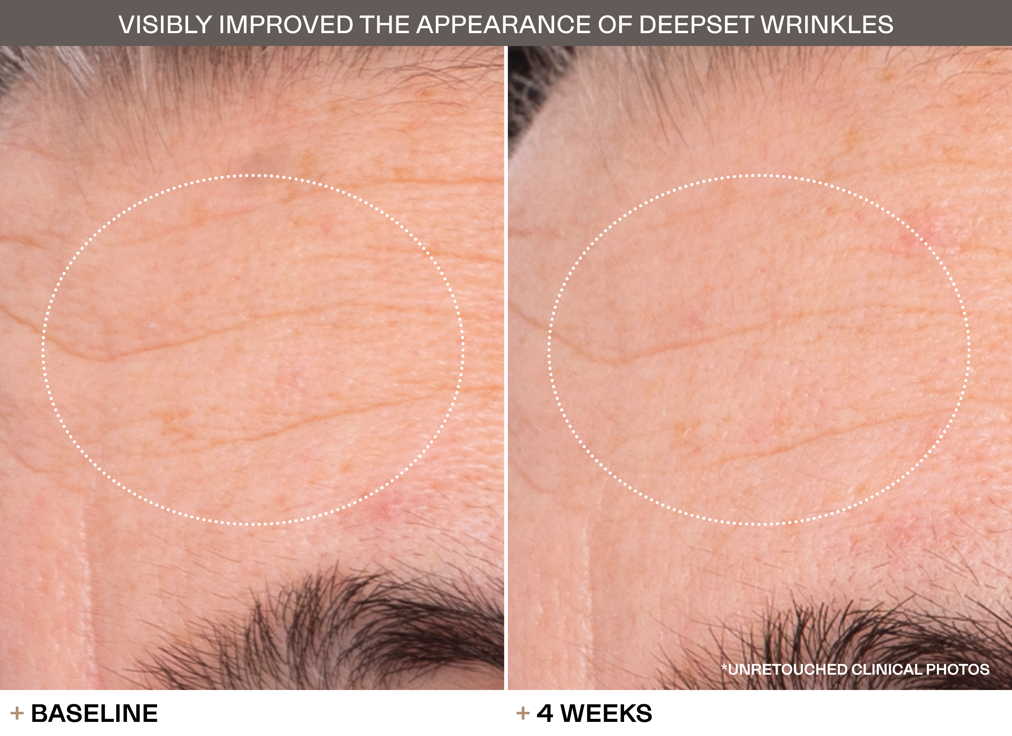 Transformations slide 5