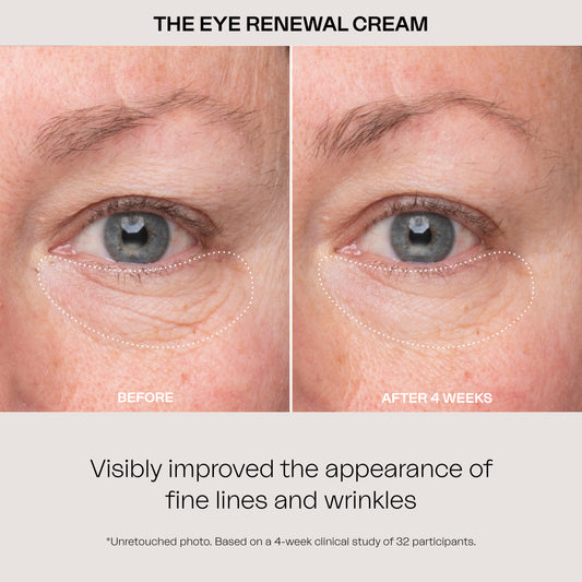 Eighth Day Skin The Eye Renewal Cream. Visibly improved the appearance of fine lines and wrinkles. Based on a 4-week clinical study of 32 participants.