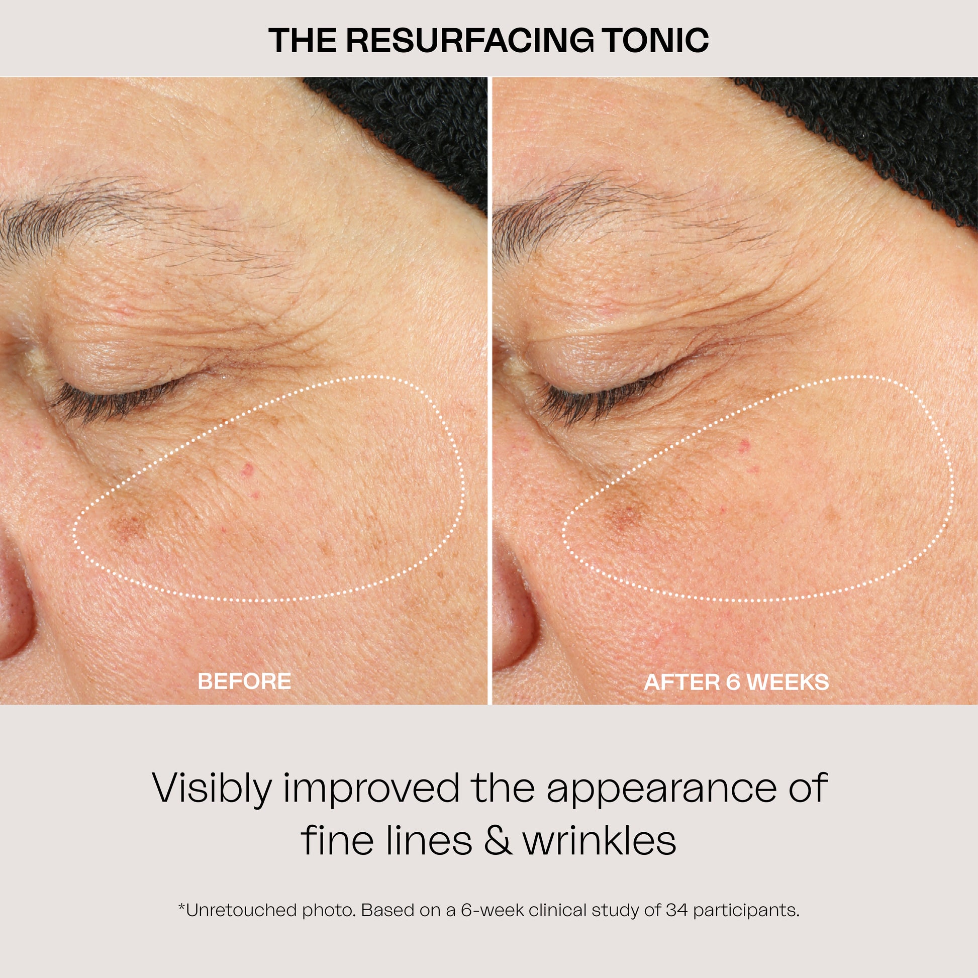 Eighth Day Skin The Resurfacing Tonic Visibly improved the appearance of fine lines and wrinkles.
