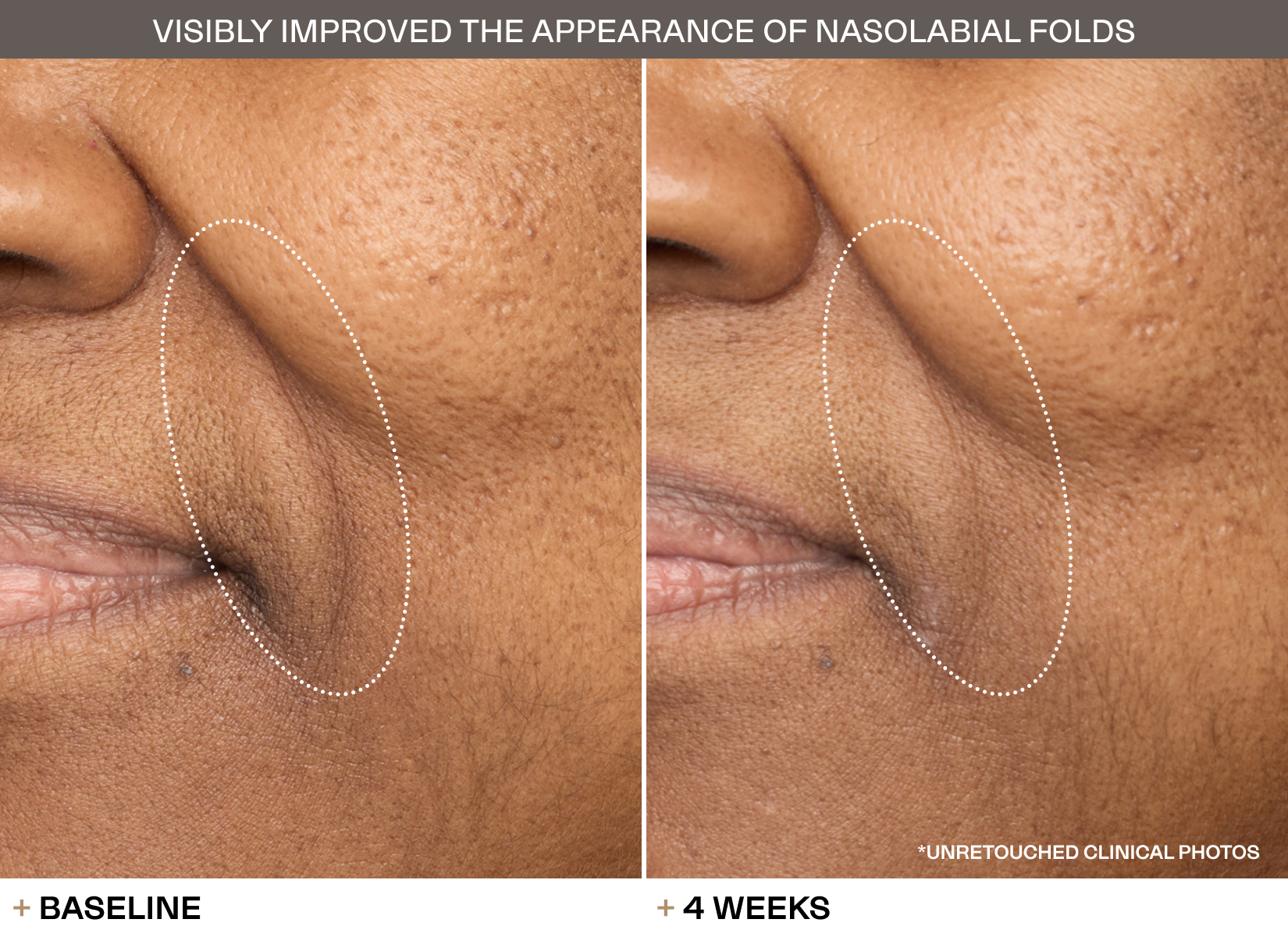 Transformations slide 1