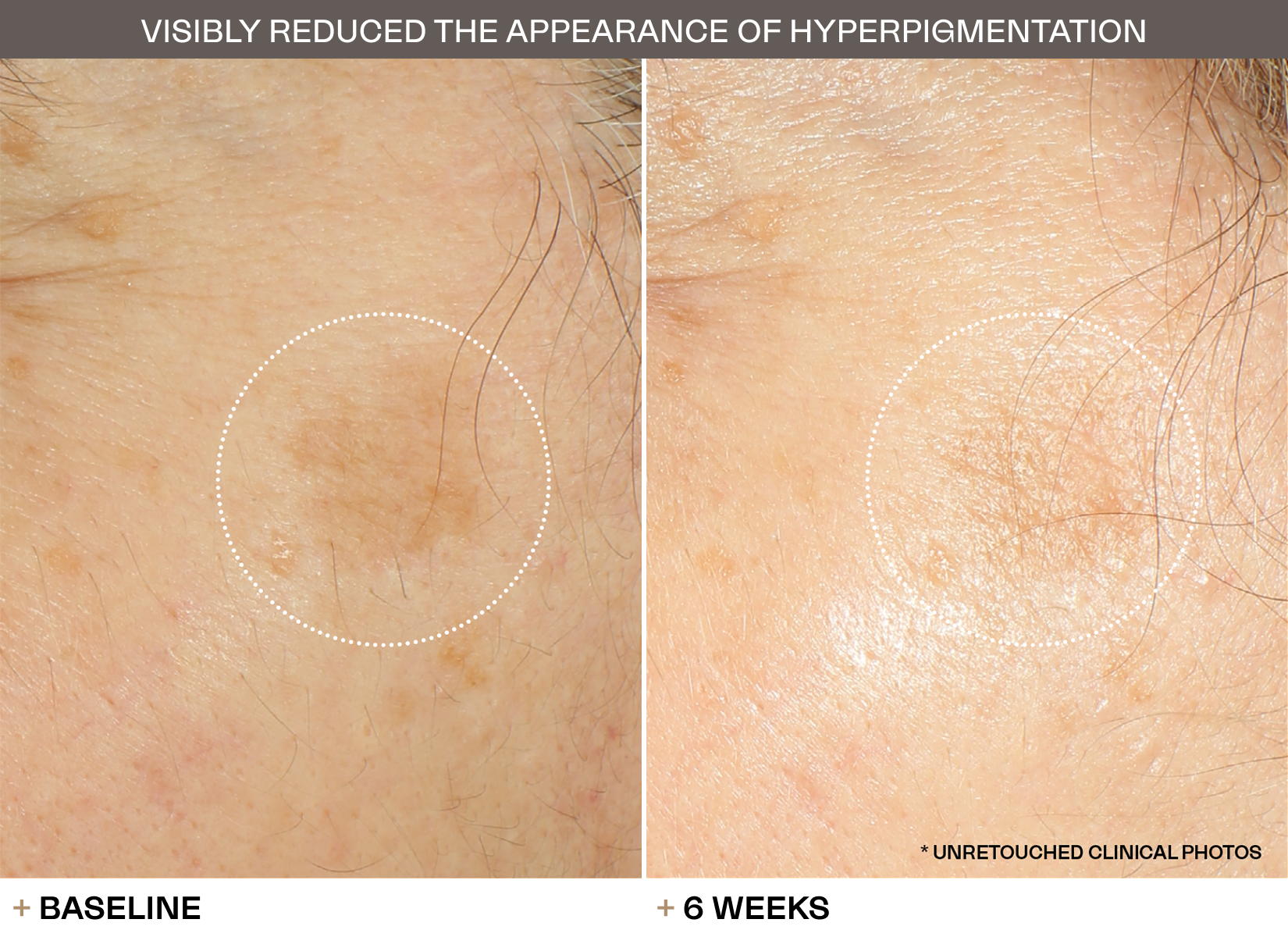 Transformations slide 2