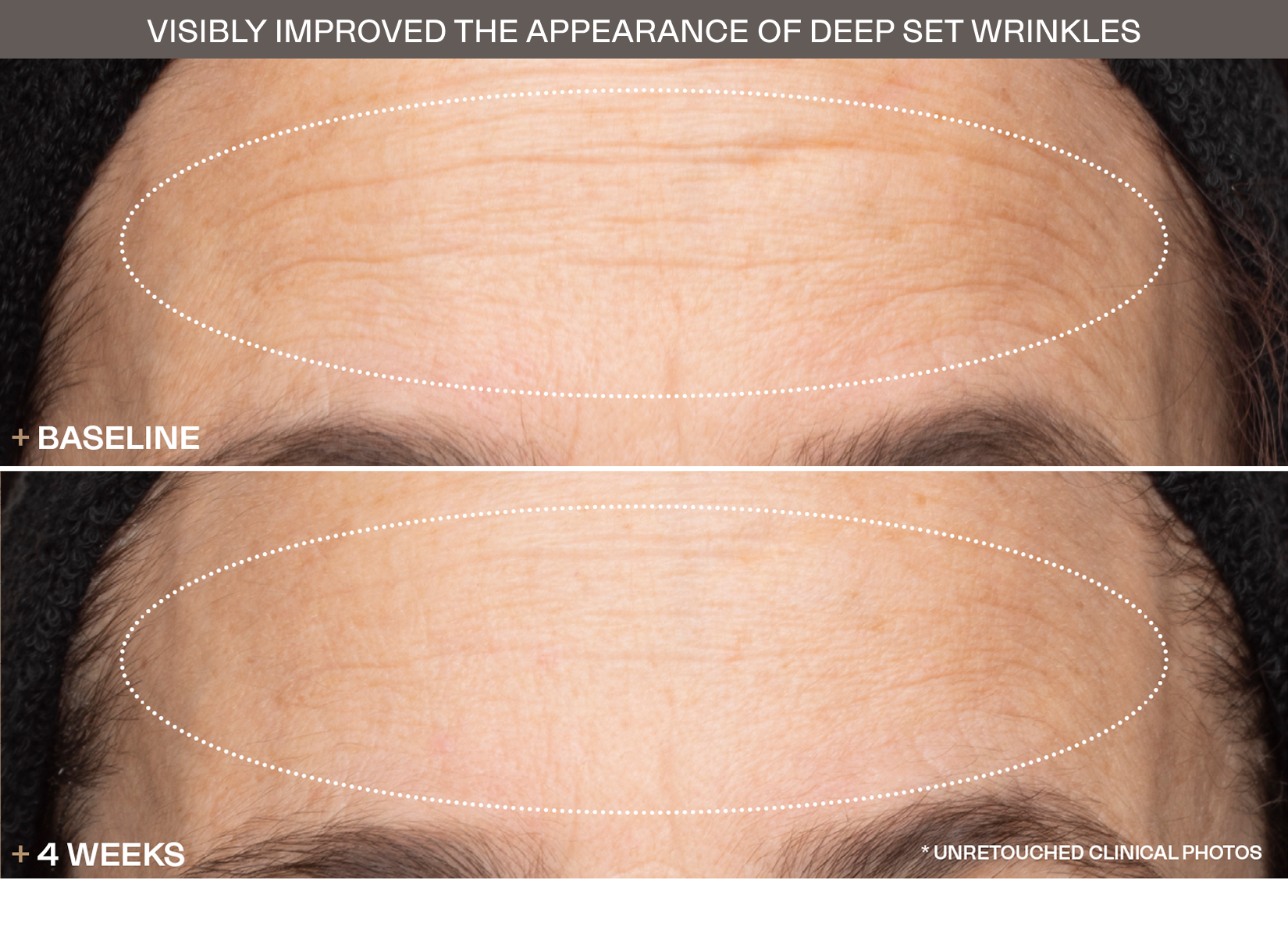 Transformations slide 3