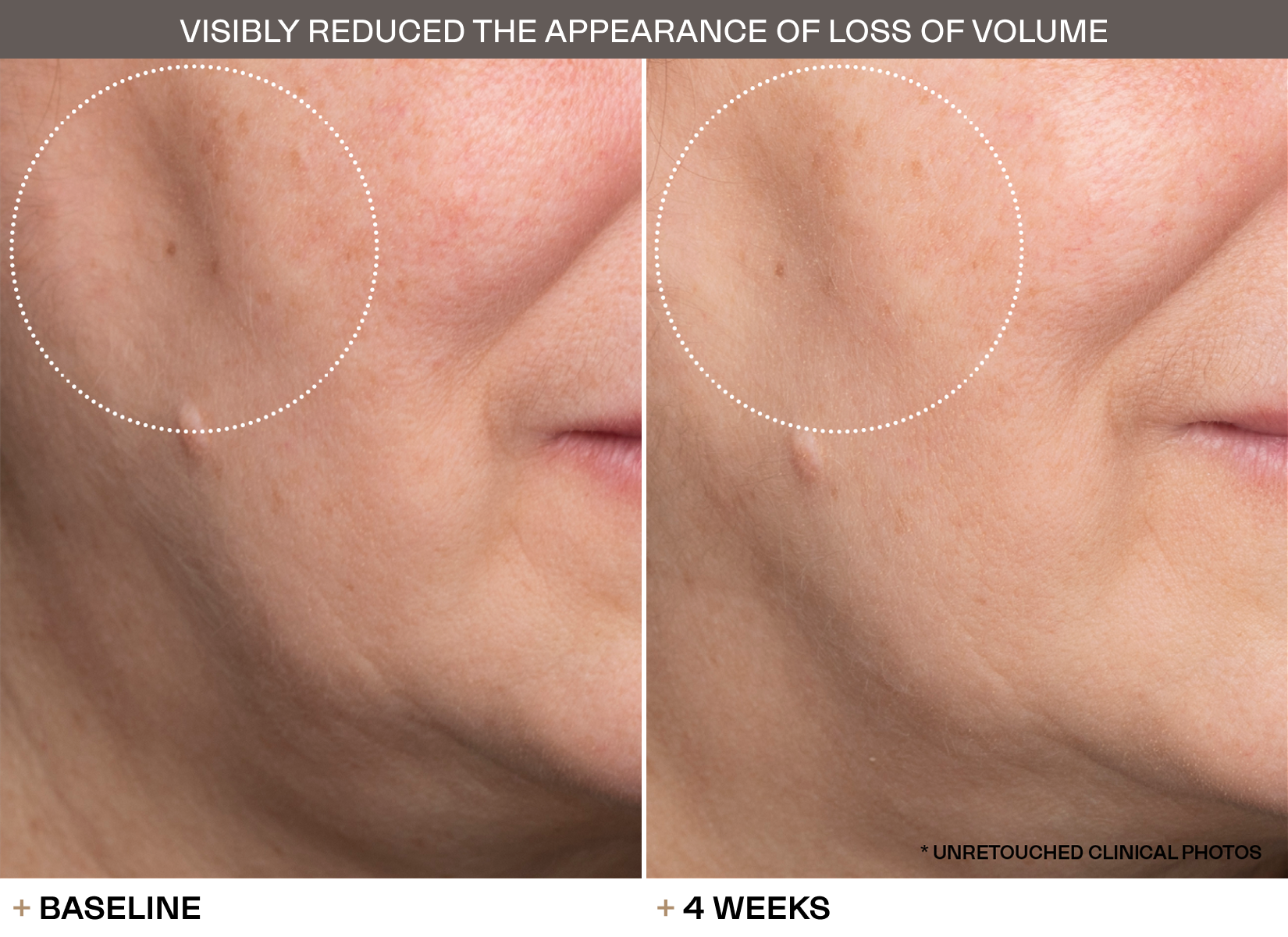 Transformations slide 4