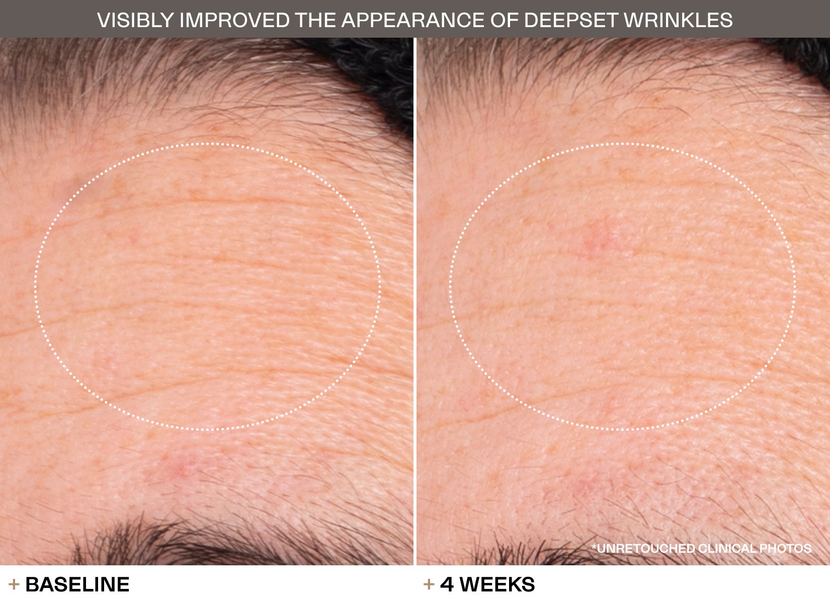 Transformations slide 5